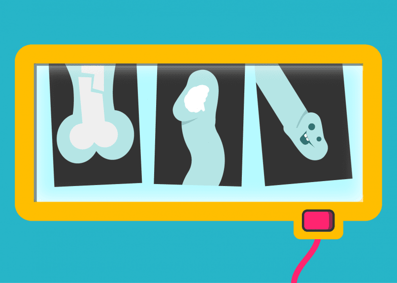 Illustration of a machine with three windows displaying cartoon representations of male genital anatomy. From left to right, the