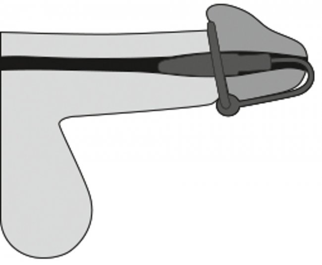 Penis Plug With Glans Ring