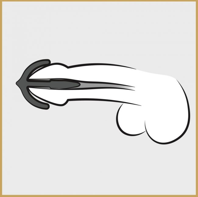 Sperm Stopper Anchor