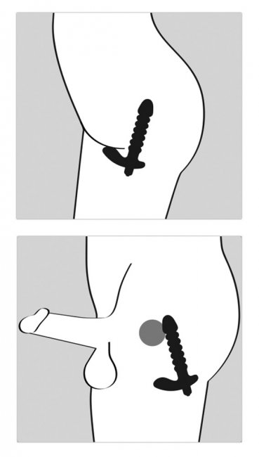 Vibrerande analplugg tillverkad av högkvalitativ silikon. Räfflar yta och en bred bas som stimulerar klitoris och perineum.