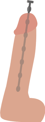 Bild på sonderad penis med dilator kallat sounding fetish